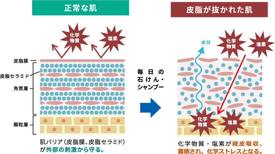 正常な肌と皮脂が抜かれた肌の比較